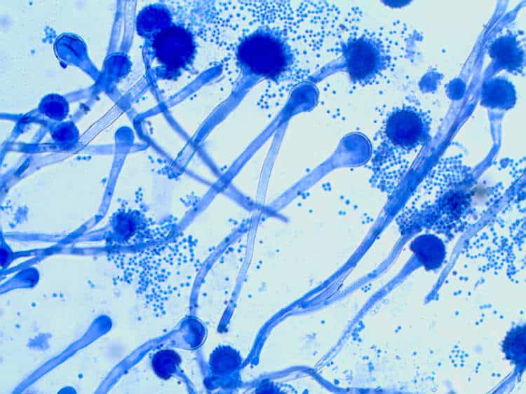 Hallitus aspergillus sp. mikroskoobis