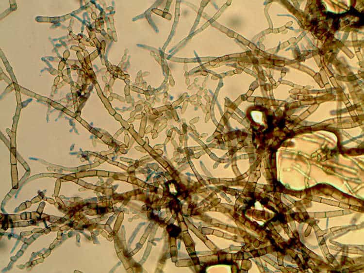 Cladosporium sp.